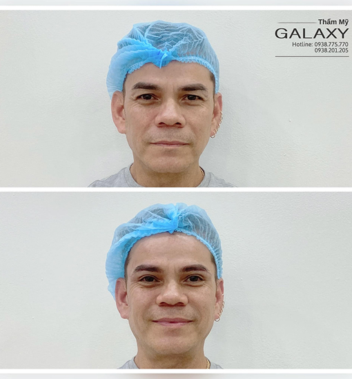 Dịch vụ treo chân mày