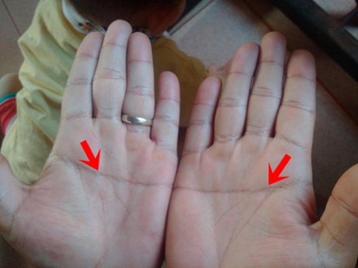 Những dấu hiệu đặc biệt trong lòng bàn tay