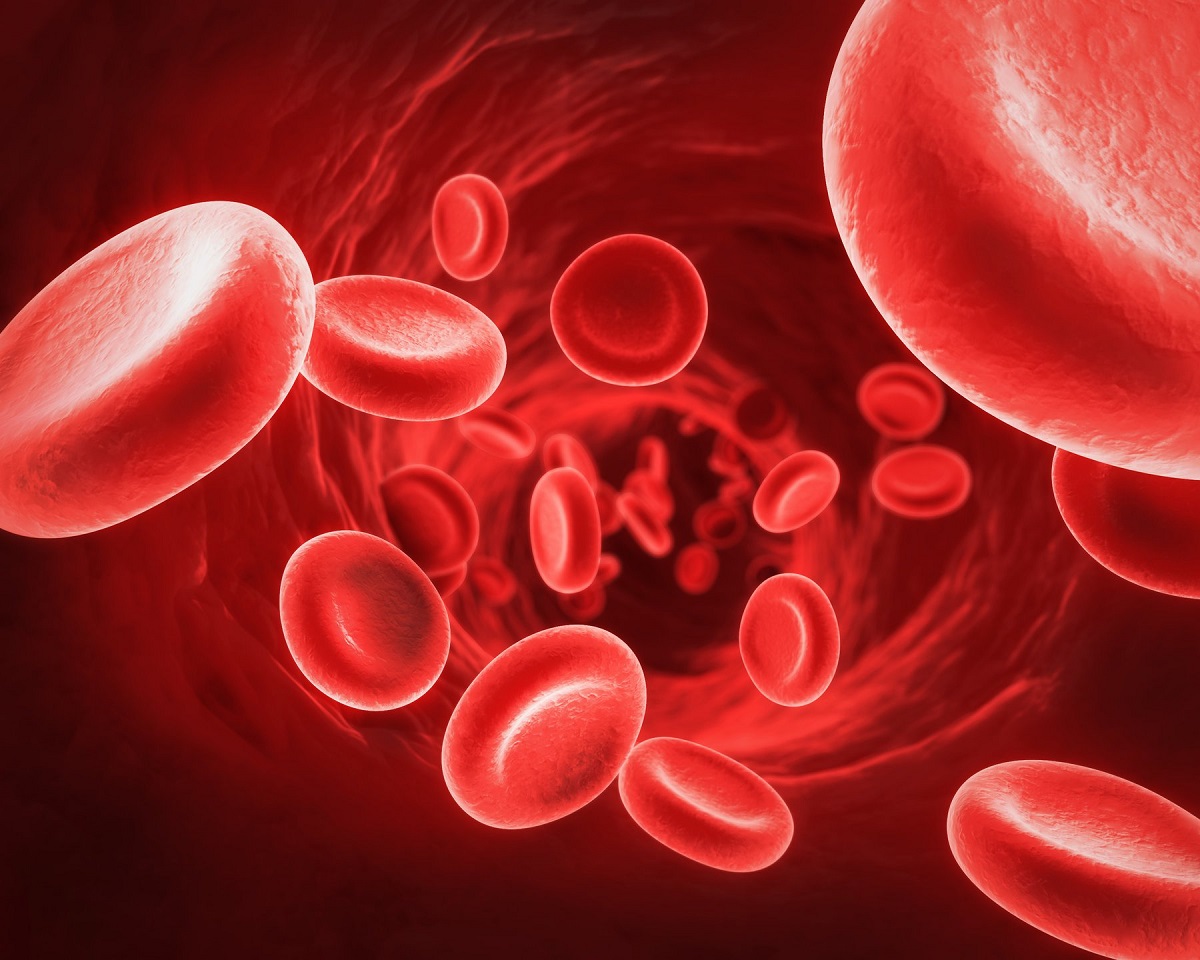 Tăng cao hồng cầu có thể gây những rối loạn nào trong cơ thể?
