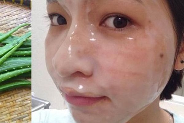 Nha đam ngâm giấm có bắt nắng không