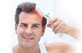 Kích thích mọc tóc bằng laser có thực sự hiệu quả?