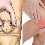 cách trị tràn dịch khớp gối