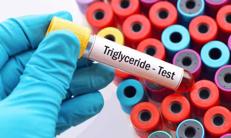 chỉ số Triglycerid và ý nghĩa của nó trong xét nghiệm mỡ máu