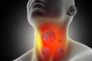 Các dấu hiệu sớm của ung thư vòm họng có thể dễ dàng phát hiện