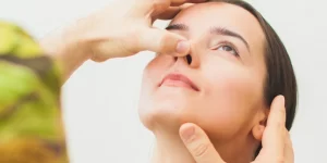 Nâng mũi có sợ va chạm không