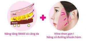 Căng da mặt mini giá bao nhiêu