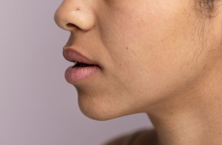 Môi có màu sẫm từ nhỏ