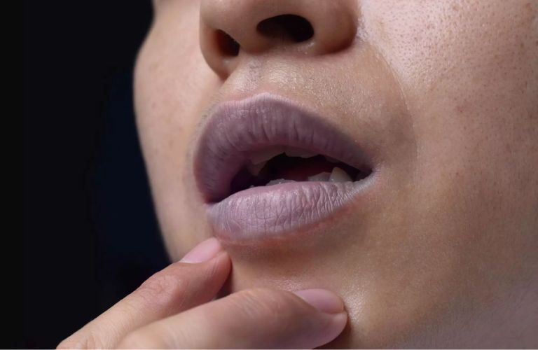 Lựa chọn phương pháp chuyên sâu khi môi thâm đậm, lâu năm