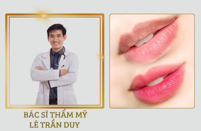 Giải pháp chuyên sâu cho tình trạng thâm mép môi với bác sĩ Lê Trần Duy