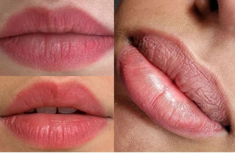 Nhiều người xăm môi bị đậm ở viền do cơ địa và quá trình lành thương