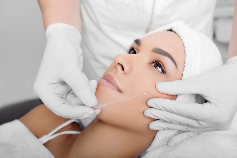 có nên căng da mặt bằng chỉ collagen