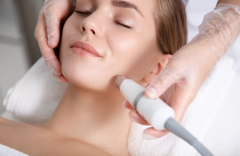 Căng da mặt không phẫu thuật bằng laser