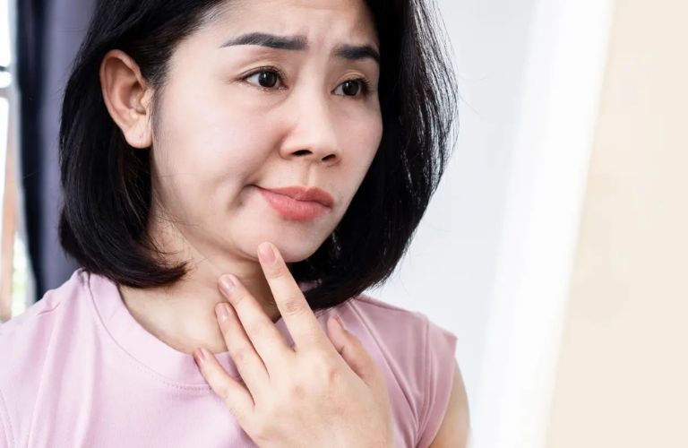 Méo miệng rõ rệt và khó khăn khi cử động miệng là những triệu chứng thường gặp