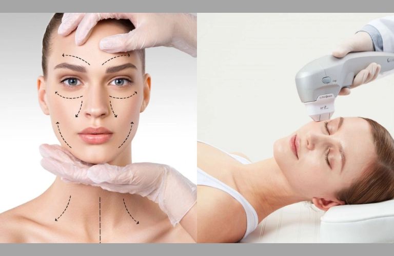 Kết quả căng da từ sóng siêu âm có thể duy trì từ 1 đến 2 năm