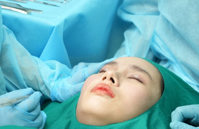 Kết quả căng da mặt bằng phẫu thuật có thể duy trì từ 5 - 10 năm