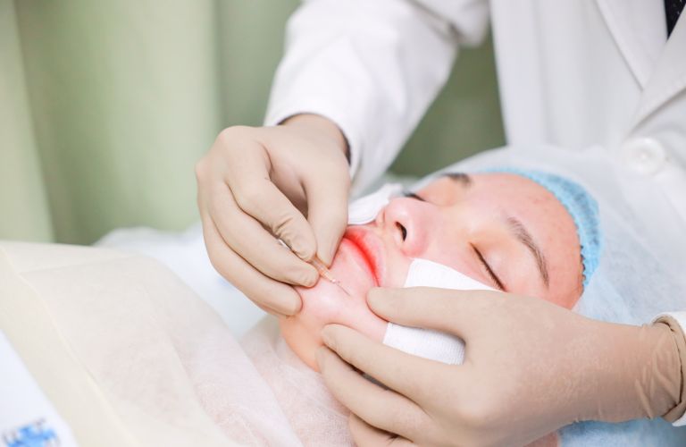 Cần lựa chọn phương pháp phù hợp