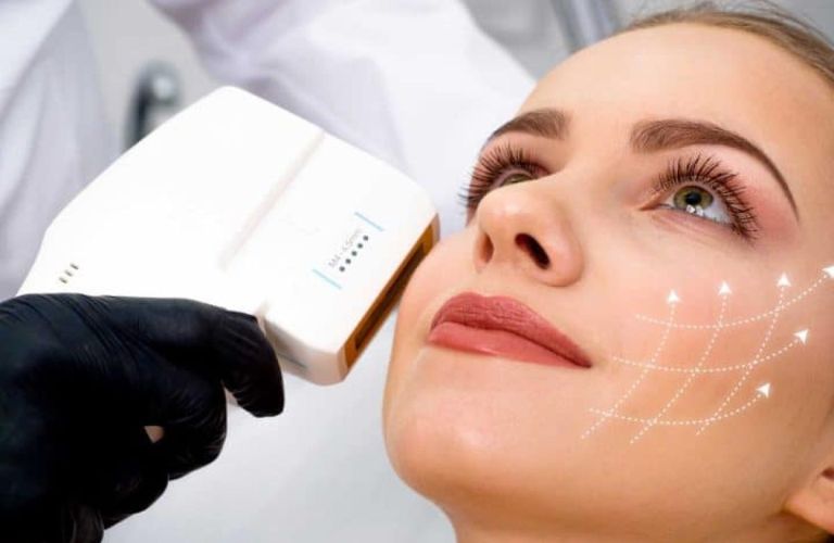 Quy trình thực hiện và chăm sóc sau căng da mặt không phẫu thuật
