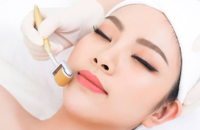 Lăn kim là một phương pháp hỗ trợ căng da mặt