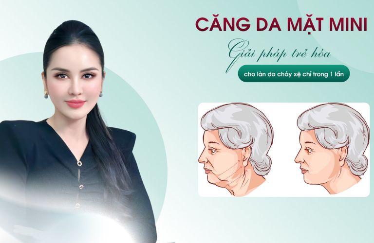 Căng da mặt mini
