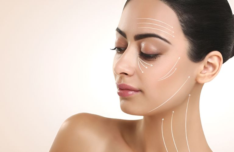 Căng da mặt SMAS thường mang đến hiệu quả tối ưu sau 1 - 3 tháng