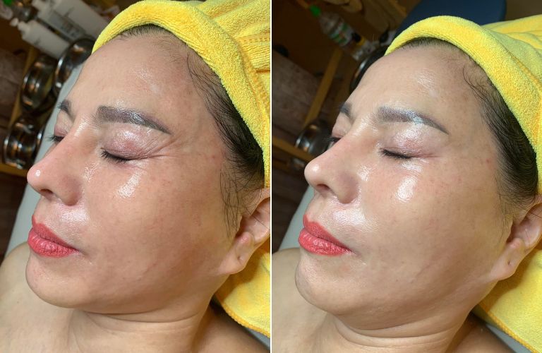 Thẩm Mỹ Viện Ngọc Hường