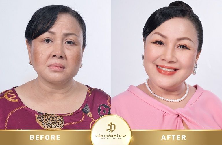 Viện Thẩm Mỹ DIVA