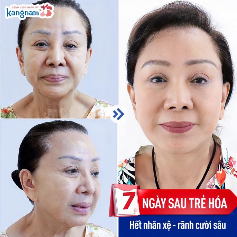 Viện Thẩm Mỹ Kangnam