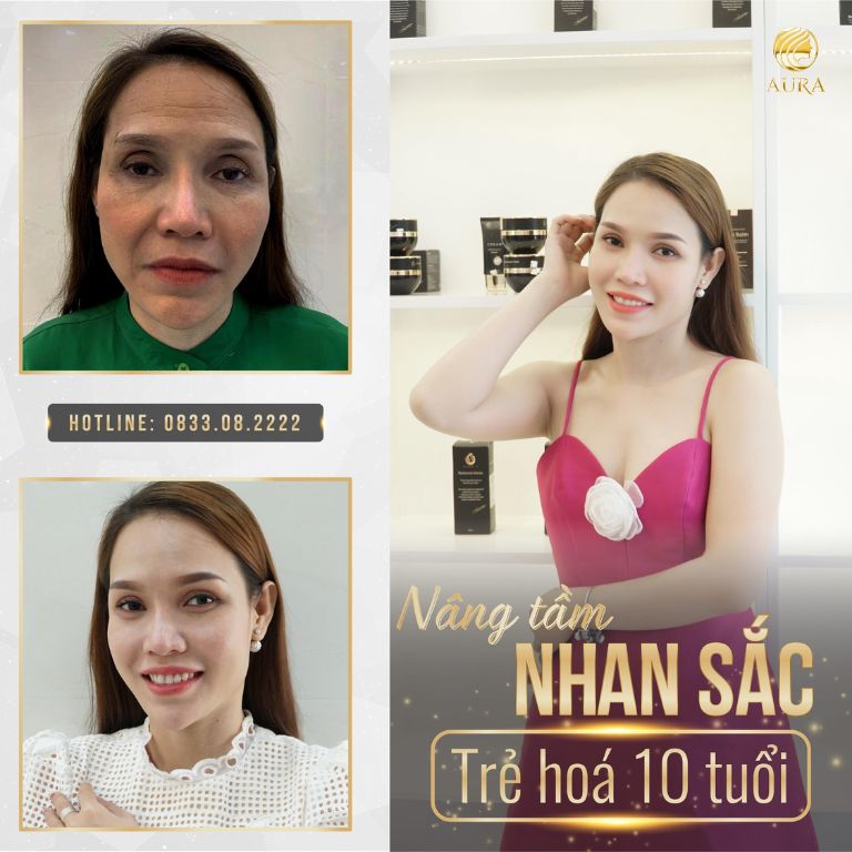 Thẩm Mỹ Viện Quốc Tế Aura