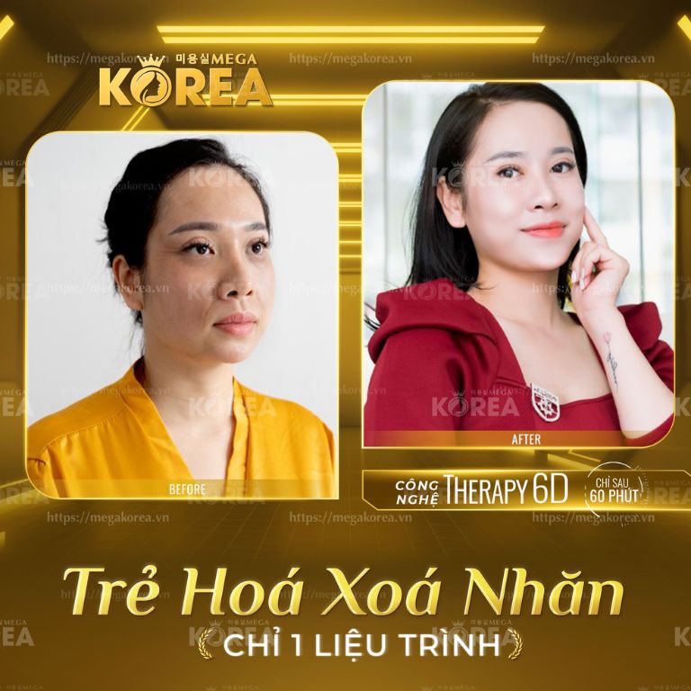 Viện Thẩm Mỹ Mega Korea