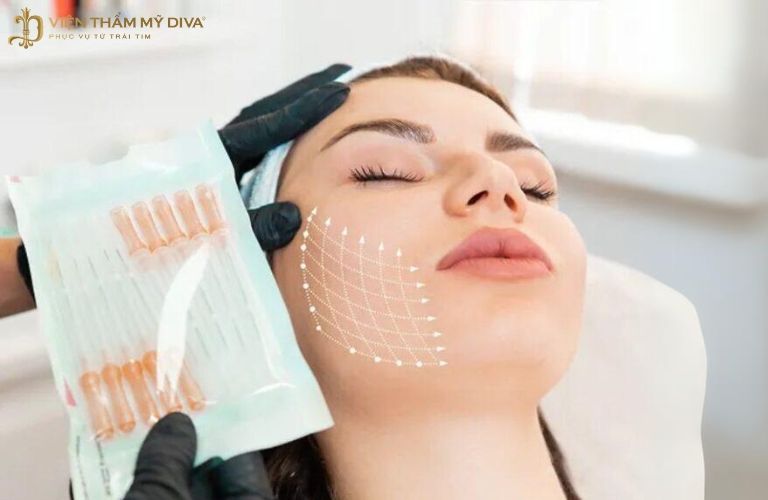 Viện thẩm mỹ Diva nổi tiếng với phương pháp căng da mặt bằng chỉ