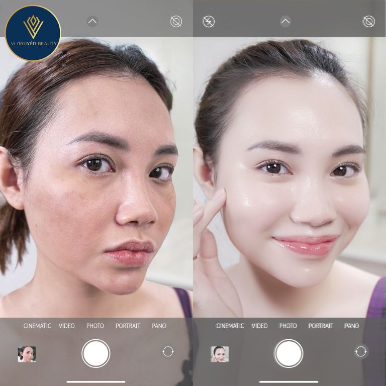 Thẩm mỹ viện Vi Nguyễn