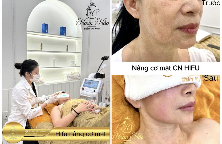 Thẩm Mỹ Viện Hoàn Hảo