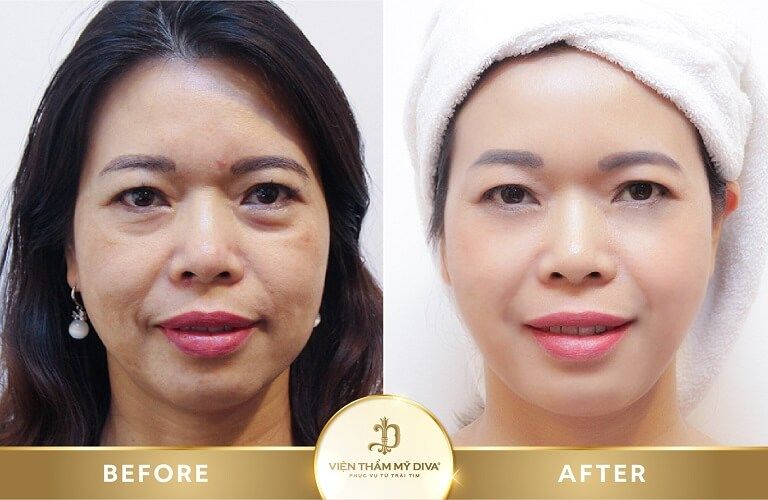 Thẩm mỹ viện DIVA