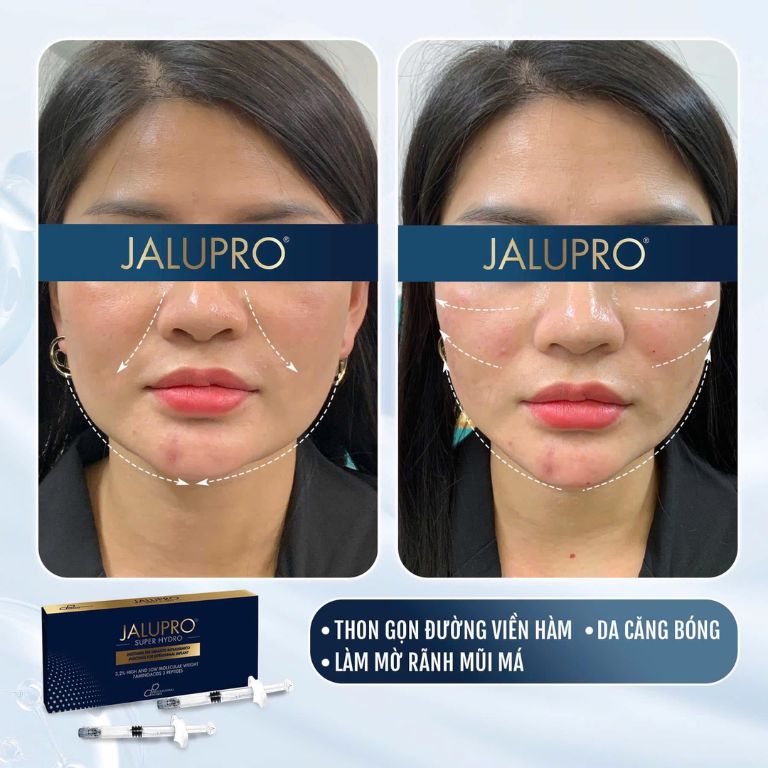 Thẩm mỹ viện Quốc tế AZ VENUS