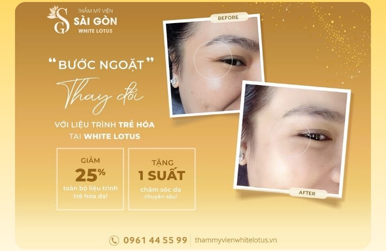 Viện Thẩm Mỹ White Lotus