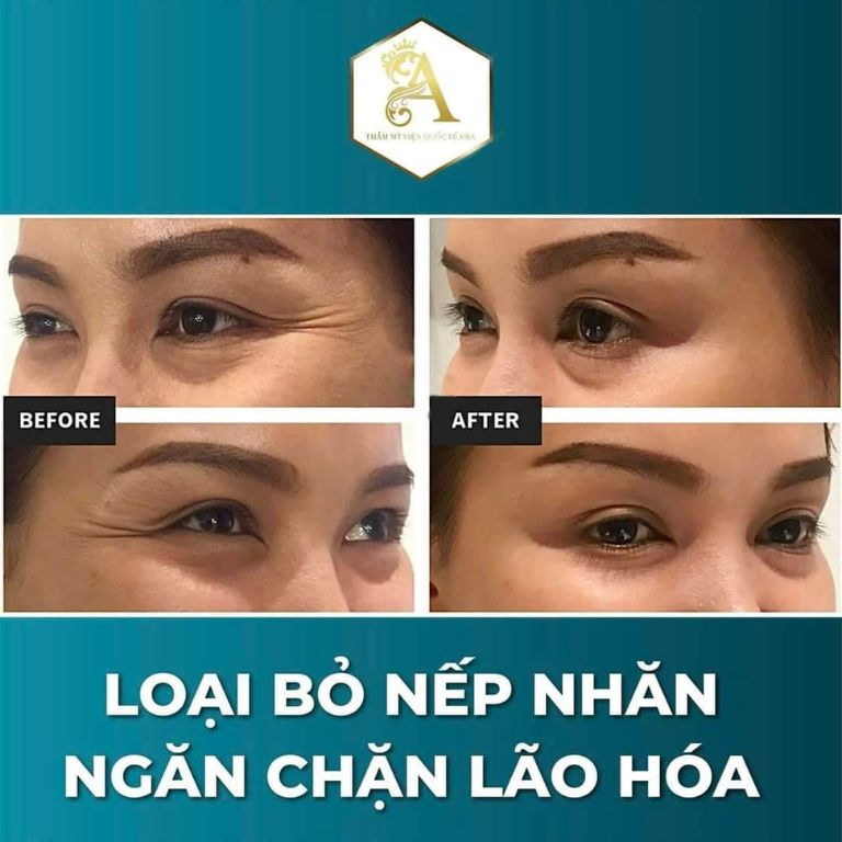 Viện Thẩm Mỹ AERA Việt Hàn