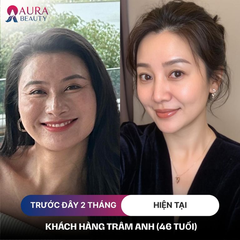 Thẩm Mỹ Viện Quốc Tế Aura