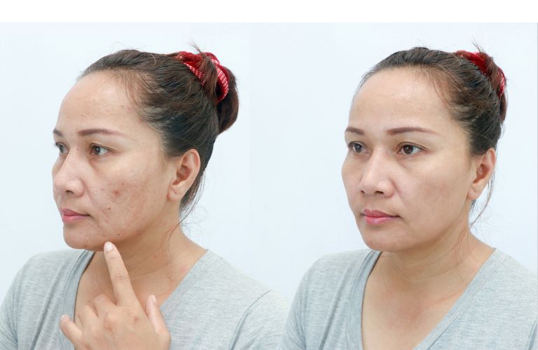 Người ở độ tuổi từ 35–60 tuổi trở lên, xuất hiện dấu hiệu lão hóa rõ rệt.