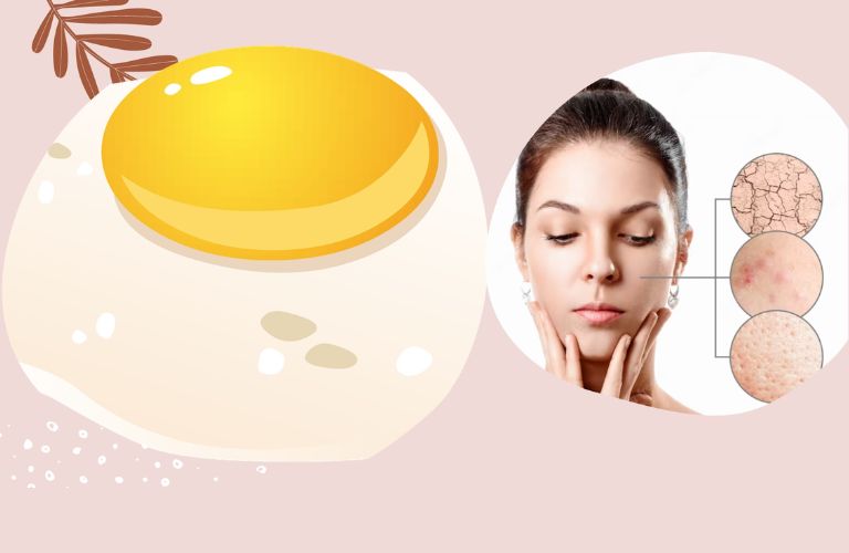 Làm căng da mặt tự nhiên, giảm mụn và se khít lỗ chân lông bằng trứng gà