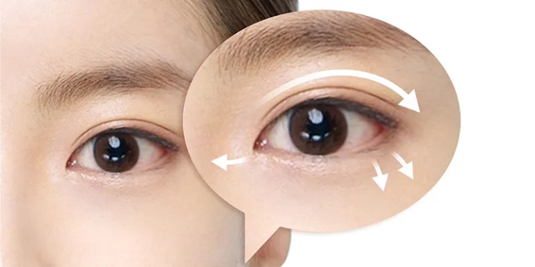 Cắt mí 1 bên bao lâu thì lành