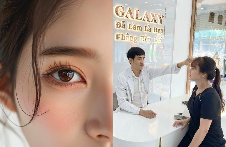 Thẩm mỹ viện Galaxy - Địa chỉ cắt mí đẹp, phục hồi nhanh
