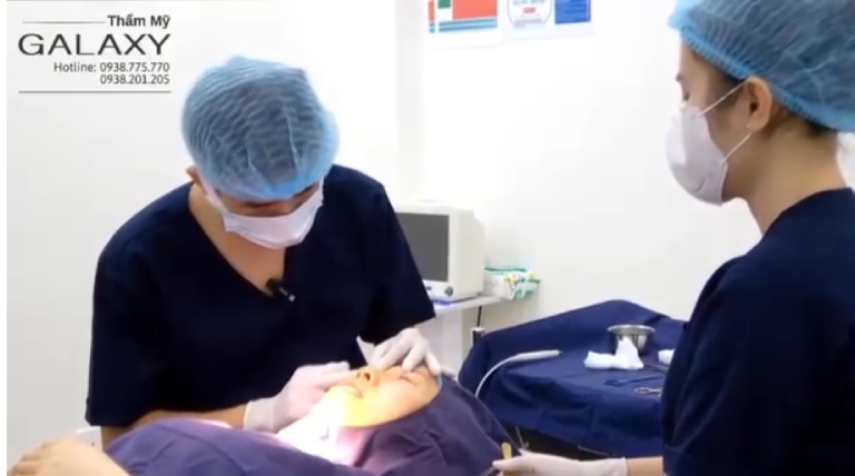 cắt mí bao lâu được rửa mặt