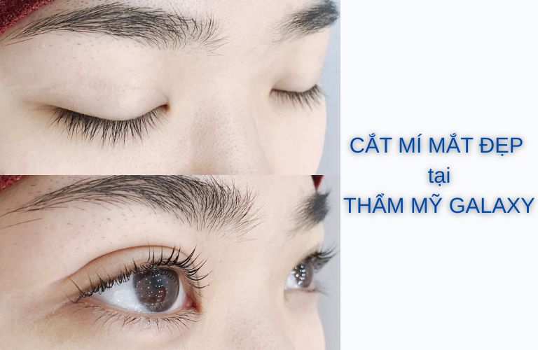 Thẩm mỹ viện Galaxy - Bác sĩ Lê Trần Duy: Giải pháp hiệu quả giúp mắt to và đẹp tự nhiên