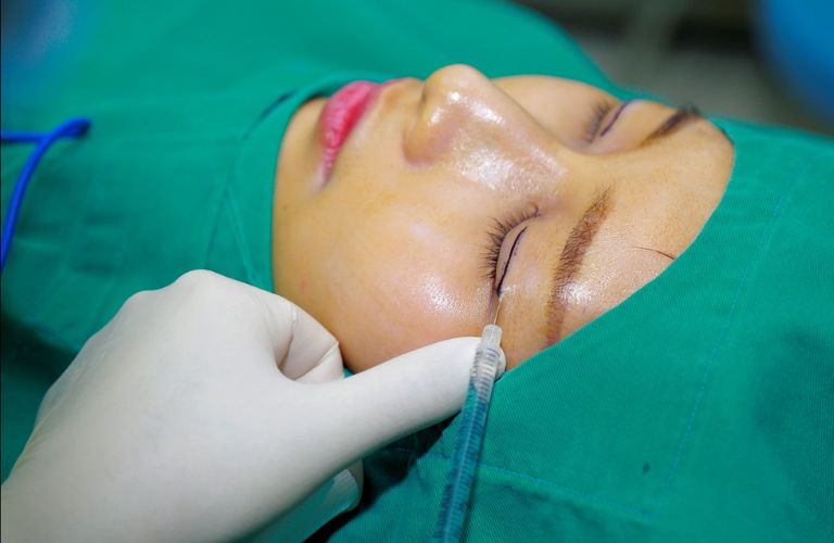 Bác sĩ sẽ gây tê vùng mắt để hạn chế cảm giác đau đớn trong suốt quá trình thực hiện
