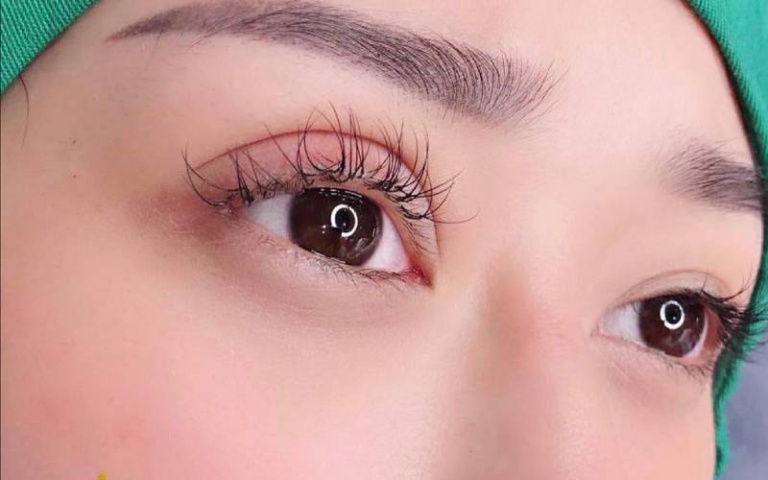 cắt mí mắt bao lâu được ăn rau muống