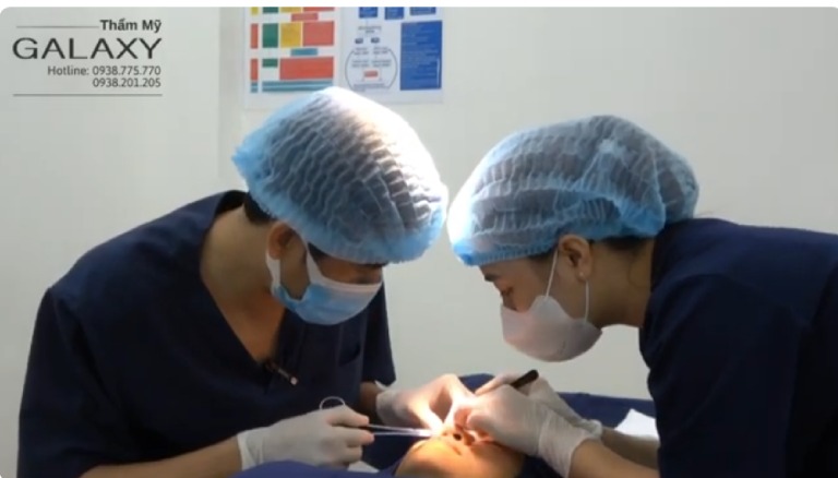 Quy trình cắt mí mắt lần 2