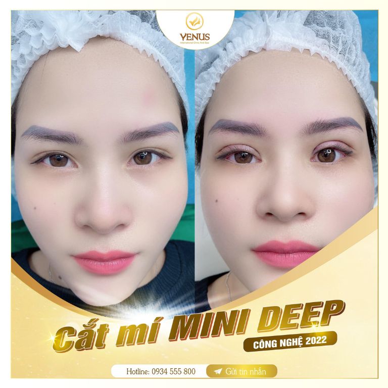 Thẩm mỹ Quốc Tế VENUS