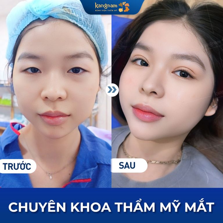 Viện Thẩm Mỹ Kangnam