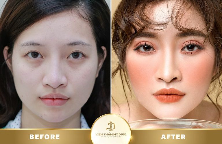 Viện thẩm mỹ DIVA