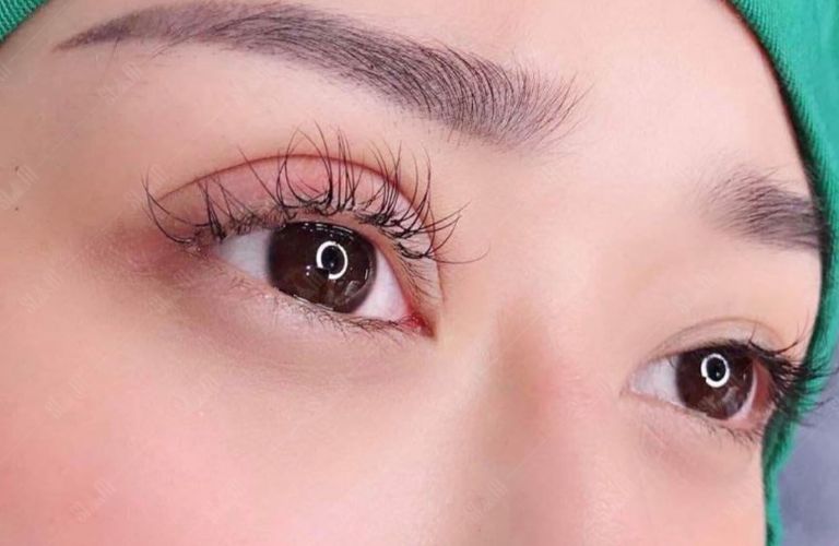 Thẩm mỹ Thủy Tiên Nasy